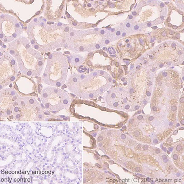 Immunohistochemistry (Formalin/PFA-fixed paraffin-embedded sections) - Anti-Zyxin antibody [EPR4302] - BSA and Azide free (AB238430)