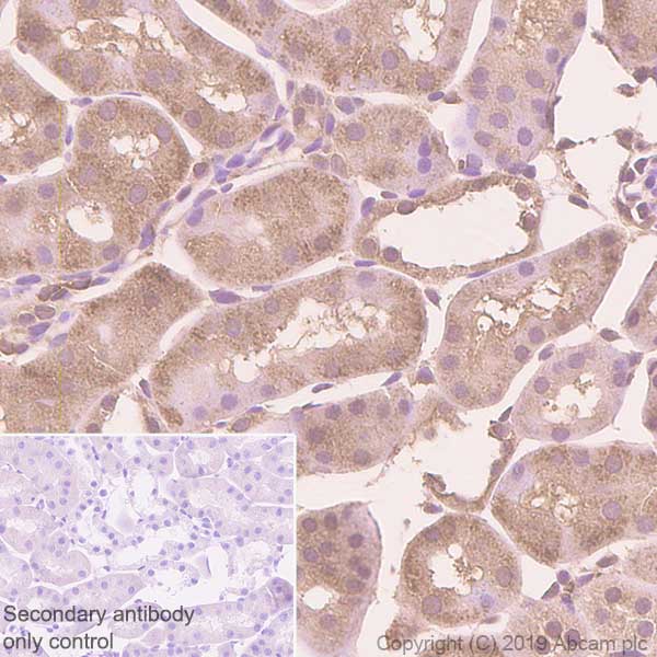 Immunohistochemistry (Formalin/PFA-fixed paraffin-embedded sections) - Anti-Zyxin antibody [EPR4302] - BSA and Azide free (ab238430), expandable thumbnail
