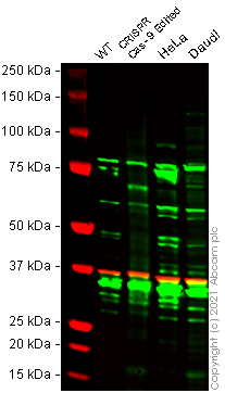 Western blot - Anti-Zyxin antibody [EPR4302] - BSA and Azide free (AB238430), expandable thumbnail