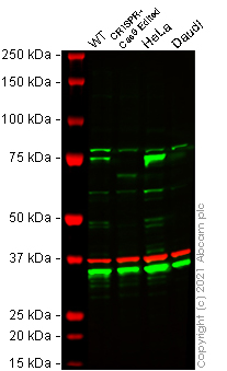 Western blot - Anti-Zyxin antibody [EPR4302] - BSA and Azide free (AB238430), expandable thumbnail