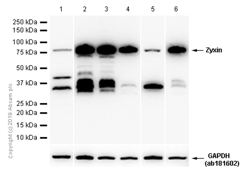 Western blot - Anti-Zyxin antibody [EPR4302] - BSA and Azide free (AB238430), expandable thumbnail