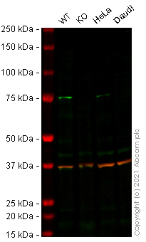 Western blot - Anti-Zyxin antibody [ZOL301] (AB50391), expandable thumbnail
