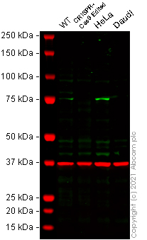 Western blot - Anti-Zyxin antibody [ZOL301] (AB50391), expandable thumbnail