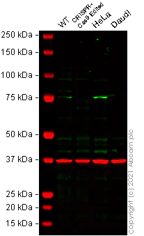 Western blot - Anti-Zyxin antibody [ZOL301] (AB50391)