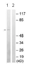 Western blot - Anti-Zyxin (phospho S142) antibody (AB78910)