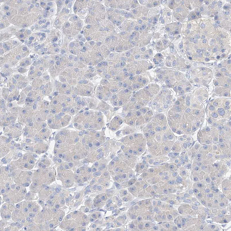 Immunohistochemistry (Formalin/PFA-fixed paraffin-embedded sections) - Anti-ZZEF1 antibody (AB122194)