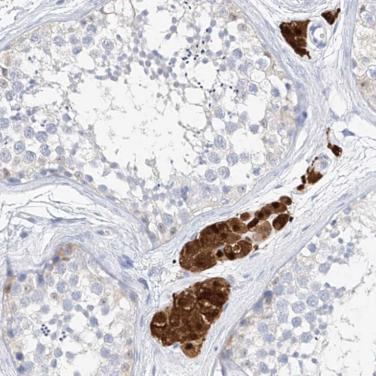 Immunohistochemistry (Formalin/PFA-fixed paraffin-embedded sections) - Anti-ZZEF1 antibody (AB122194)