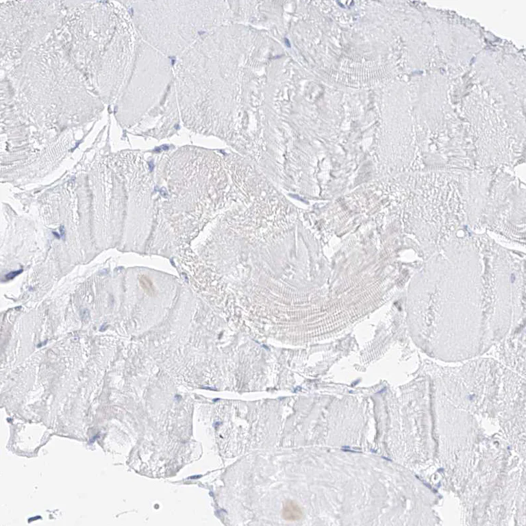 Immunohistochemistry (Formalin/PFA-fixed paraffin-embedded sections) - Anti-ZZEF1 antibody (AB122194)